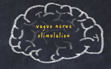 Drawind of human brain on chalkboard with inscription vagus nerve stimulation