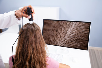 Dermatologist Using Trichoscope For Hair Fall Treatment