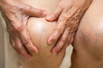 Senior woman suffering from knees pain sitting on chair, Massaging by her hand, Close up, Body concept