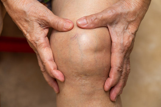Senior woman suffering from knee pain sitting on chair, Massaging by her hand, Close up, Body concept