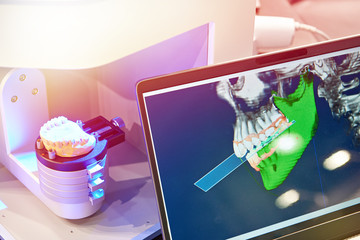 Modern dental equipment for dentures