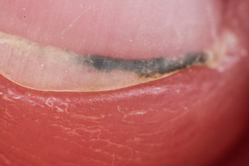 Fototapeta premium Dirt stuck under the man nail super macro