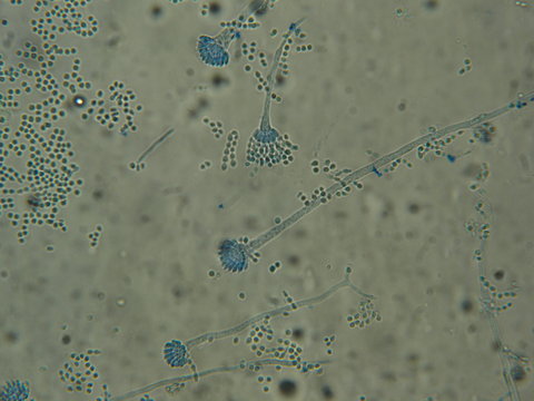 Aspergillus Sp