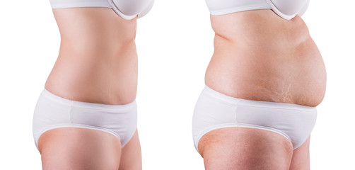Elderly woman before and after weight loss, isolated on white background