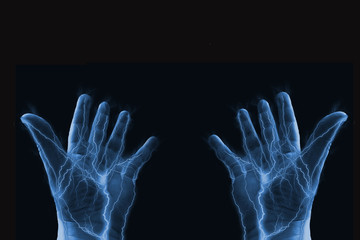 electrified hands held open in disbelief