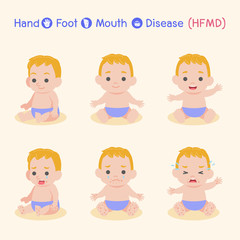 Set of baby Children infected and healthy, Boy have a Hand Foot Mouth Disease, HFMD in rain season, Medical Health care concept, cartoon character vector Info-graphic.