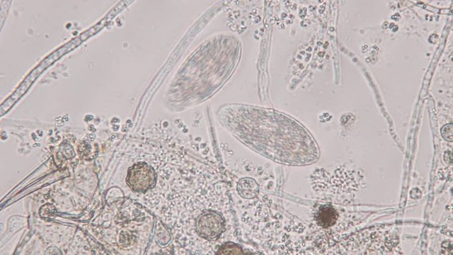 Paramecium caudatum is a genus of unicellular ciliated protozoan and Bacterium under the microscope.