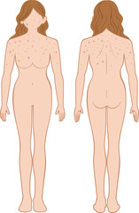 Fototapeta premium できもの 全身 女性