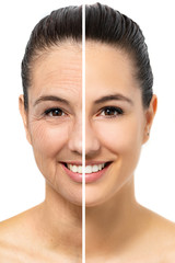Conceptual female facial aging.