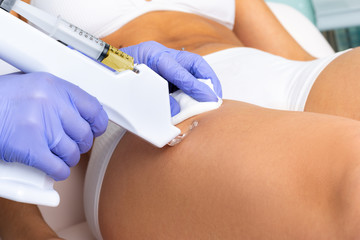 Therapist reducing cellulite with micro needle technology on female thigh.