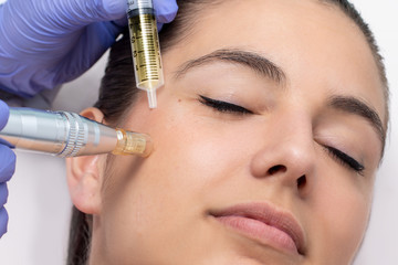 Woman having derma pen facial treatment.