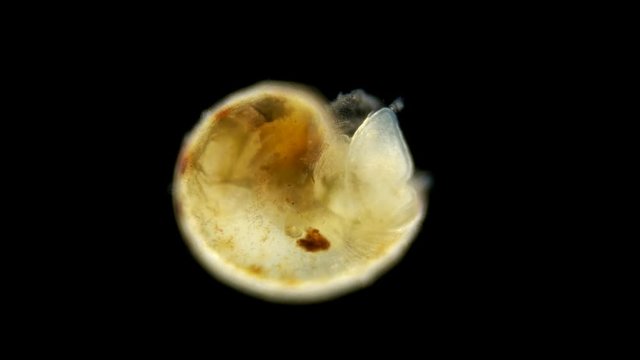 Black Sea plankton and zooplankton under a microscope, the Gastropoda mollusk larva, already formed, ready to fall to the bottom and crawl