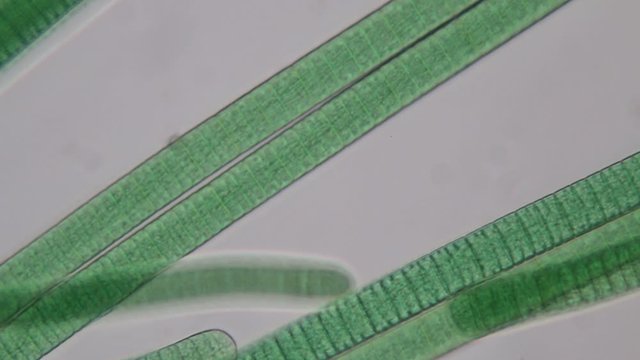 Study of Oscillatoria is a genus of filamentous cyanobacterium, oscillation in its movement under the microscope. 