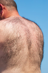 Obraz premium a lot of hair on the male back
