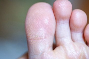 Fototapeta premium Men's toes, healthy toe nails