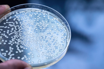 Bacteria Agar culture on Petri plate, lab test