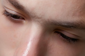 Fused eyebrow between the eyes on the nose. Close-up of part of the face of a teenager guy.Preparation for the procedure for removing facial hair in a beauty salon. Sugaring. Epilation.