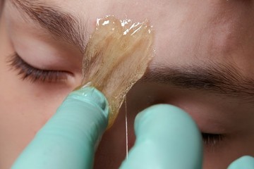 A beautician with gloves puts a piece of sugar paste on the nose bridge with hairs between the eyebrows. Cosmetology procedure. Close-up of part of the face of a teenager guy. Sugaring. Epilation.