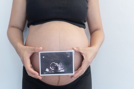 Pregnant woman showing fetus ultrasound  photo.