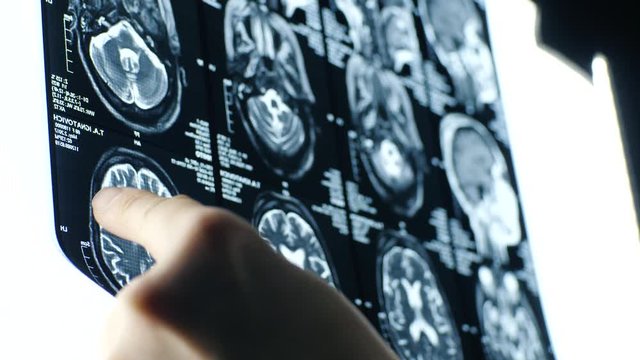 Doctor eyes examining a tomographic image close up