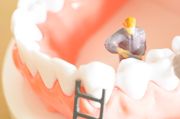Miniature worker model cleaning teeth for dental clinic, good health care demonstrate how to clean, fix, taking care of teeth
