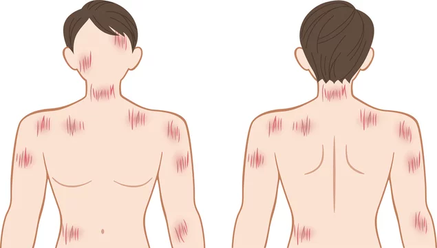 ひっかき傷 上半身 男性 Stock Vector Adobe Stock