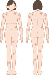 Fototapeta premium ひっかき傷 全身 女性