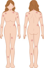 Fototapeta premium ひっかき傷 全身 女性