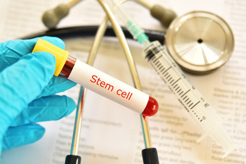 Blood sample tube contain with stem cell