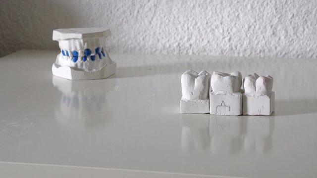 Dentist line up models of teets for prosthetic denture jaw