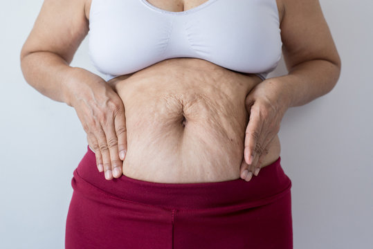 Overweight senior woman pinching her fat body,Cellulite squeezing her belly fat around her belly button, Obesity in the senior concept