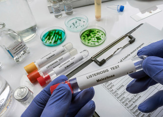 Expert analyzes stuffed meat contaminated by bacterium of listeria in laboratory, sprout caused in...