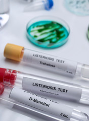 Samples you analyze of stuffed meat contaminated by bacterium of listeria in laboratory, sprout caused in Spain