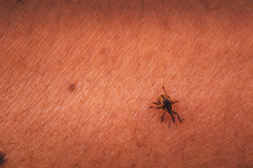 The little bug on human arm skin texture background