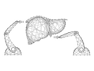 Surgical operation on the human liver by robotic arms manipulator innovative concept from abstract futuristic polygonal black lines and dots. Vector illustration.
