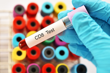 Obraz premium Blood sample tube for cytotoxic T cell lymphocyte or CD8 test