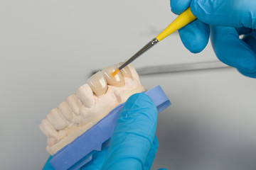 close up of painting work at dental imprint with artificial dentition in a dental laboratory
