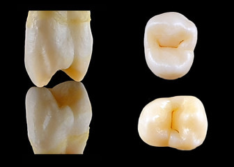 Prämolar
