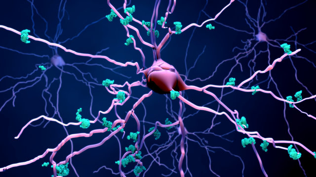 Death Of Neurons In The Aging Brain Or Proteins In Neurons