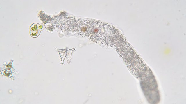 Amoeba proteus this small protozoan uses tentacular protuberances called pseudopodia to move and phagocytose smaller unicellular organisms.