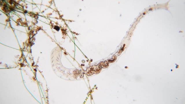 Tubifex worm under the microscope view for education.