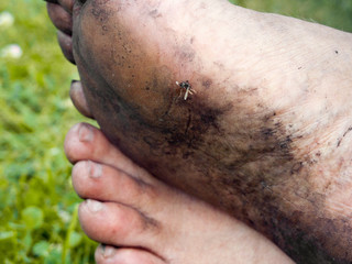 Naklejka premium smashed mosquito on the bare feet