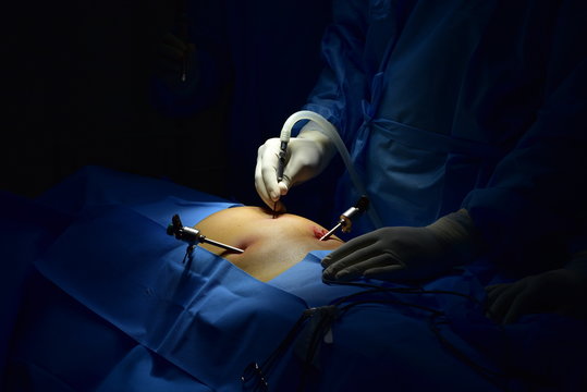 Laparoscopic Surgery