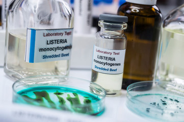 Samples you analyze of stuffed meat contaminated by bacterium of listeria in laboratory, sprout caused in Spain