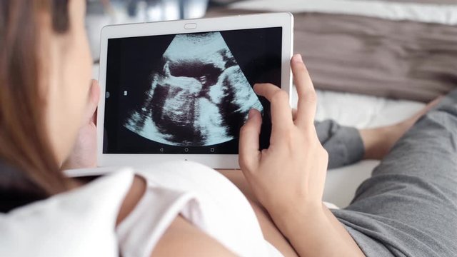 Beautiful young pregnant woman looking ultrasound of her baby on digital tablet while lying on bed.