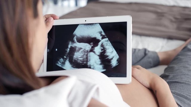 Beautiful young pregnant woman looking ultrasound of her baby on digital tablet while lying on bed.