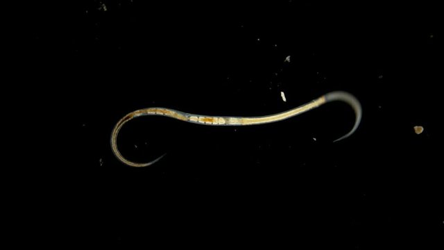 Black Sea plankton and zooplankton under the microscope, sea worm nematode, leads a parasitic lifestyle