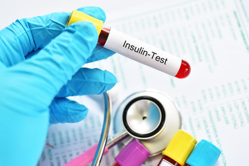 Blood sample tube for insulin hormone test, diabetes diagnosis 