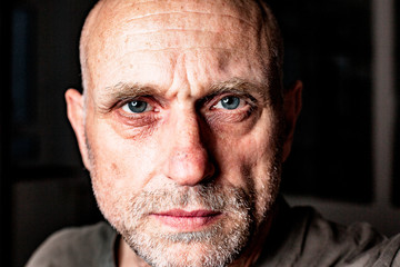 old man a thousand scratches