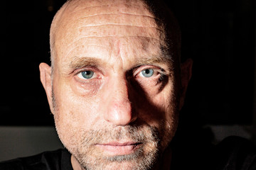 old man a thousand scratches